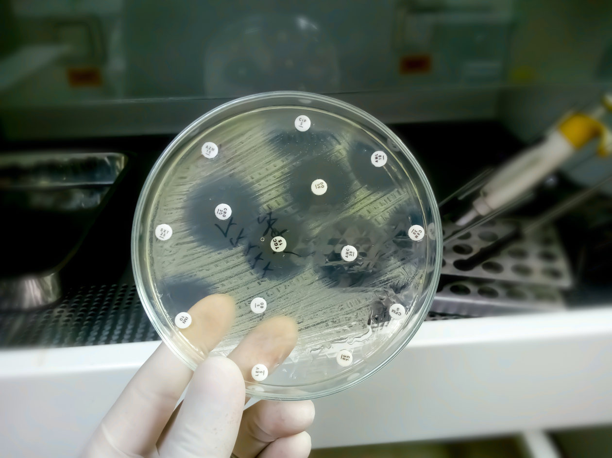 Avaliação de processos em microbiologia